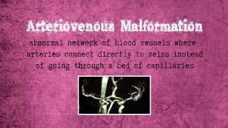 Arteriovenous Malformation [upl. by Enegue276]