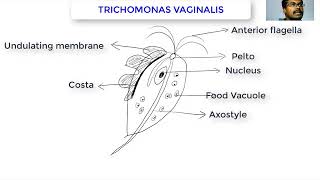 Trichomonas vaginalis [upl. by Henden]