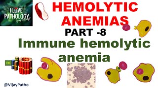 Hemolytic Anemias Part 8 Immune Hemolytic Anemia IHA [upl. by Analem]