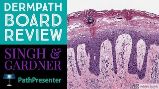 Dermpath Board Review 100 Classic Cases [upl. by Hedveh]