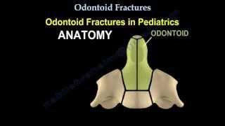 Odontoid Fractures  Everything You Need To Know  Dr Nabil Ebraheim [upl. by Shishko]