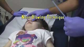 Nasal Foreign Body Removal Techniques [upl. by Dagny644]