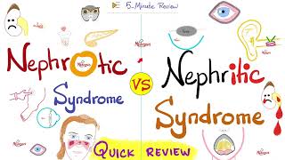 Nephrotic AND Nephritic Syndrome  Quick Review  Nephrology amp Pathology [upl. by Svend]