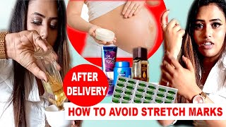 HOW TO AVOID STRETCH MARKS  TIPS  AFTER DELIVERY [upl. by Mossberg847]