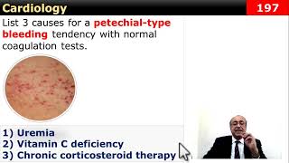 internalmedicine cme usmle محاضراتباطنة ecg كورساتباطنة clinical clinical medicine [upl. by Iphigeniah]