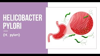 Helicobacter pylori H pylori [upl. by Htrap587]