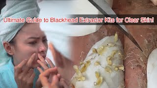 Ultimate Guide to Blackhead Extractor Kits for Clear Skin [upl. by Akinek]