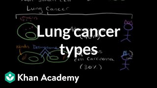 Lung cancer types  Respiratory system diseases  NCLEXRN  Khan Academy [upl. by Eelsew]