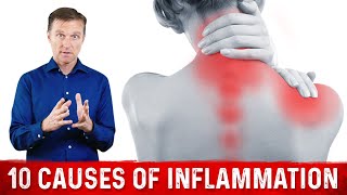 10 Common Causes of Inflammation in the Body – Dr Berg [upl. by Kosak793]