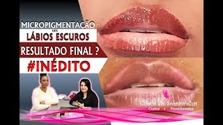 NEUTRALIZAÇÃO DE LÁBIOS ESCUROS  A CICATRIZAÇÃO QUE NINGUÉM TE MOSTRA  INÉDITO NO YOUTUBE [upl. by Ysteb784]