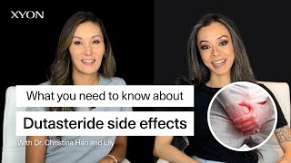 Dutasteride Side Effects What Are The Side Effects Do They Go away [upl. by Seligmann]