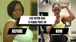 My VSG Weight Loss Surgery Journey Success and Regrets 9 Years Later [upl. by Luthanen]