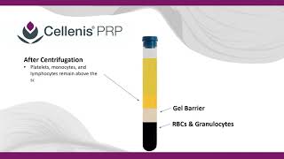 Cellenis PRP for patients How it works [upl. by Ioyal]