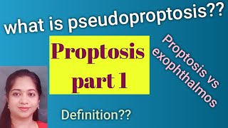 Proptosis Exophthalmos Pseudoproptosis Causes for psuedoproptosis MBBS Ophthalmology [upl. by Oicram564]