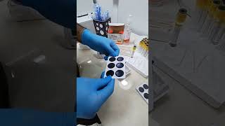 کیفە اجراء تحلیلRF ڕۆماتیزمی جومگەRhumatoid Factor [upl. by Nohcim467]