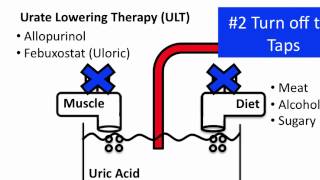 Understanding Gout [upl. by Leilamag]