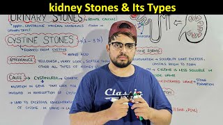 Urinary or Kidney stones Types of Kidney Stones Detailed Lecture [upl. by Drucill210]