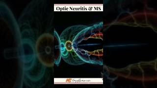 How To Recognize Optic Neuritis And MS [upl. by Malo]