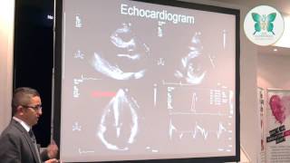 Advanced diagnostics in inherited cardiac conditions SADSconf2017 [upl. by Durarte]