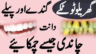 Danto ko safed karne ka totka danto ki safai kaise hoti hai teeth whitening at home  beautytips [upl. by Helbon]