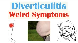 Weird Symptoms of Diverticulitis  Atypical Clinical Features of Diverticulitis [upl. by Aliet]