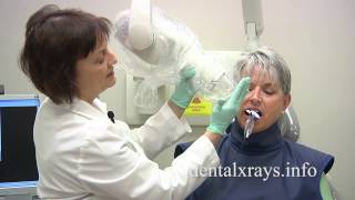 How to take dental xrays with bisecting angle positioning [upl. by Hsizan816]