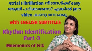 How to identity Atrial Fibrillation Easy way in malayalam for nursesRhythm Identification Part3 [upl. by Odnamla]