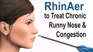 RhinAer to Treat Chronic Runny Nose and Congestion [upl. by Leinad]