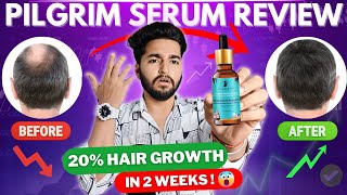 Pilgrim Redensyl and Anagain Advanced Hair Growth Serum Review [upl. by Airehtfele]