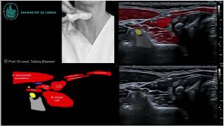 Sonographische Darstellung der vorderen Halsmuskeln [upl. by Thorvald]