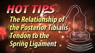 The Relationship of the Posterior Tibialis Tendon to the Spring Ligament [upl. by Ahsimat]