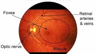 Medical Video LecturesUnderstanding Age Related Macular Degeneration ARMDAMDby Ophthalmologist [upl. by Rehoptsirhc]