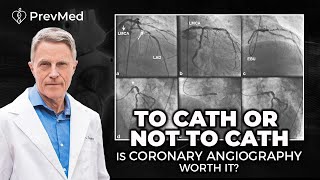 To Cath or Not to Cath  Is Coronary Angiography Worth It [upl. by Missie]