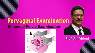 Bimanual PV Examination [upl. by Uah]