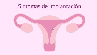 SÍNTOMAS de la IMPLANTACIÓN del EMBRIÓN en el ÚTERO 🤰🏻 ¿Estoy Embarazada [upl. by Kursh427]