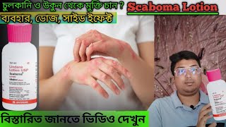 Scaboma Lotion  Scaboma Lotion Uses DoseSide Effect in Bengali  Scabies Treatment  Scaboma [upl. by Sherill201]