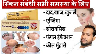 मात्र 5 दिन मे दाद खाज खुजली जड़ खत्म ।। dad khaj khujali ki dava ।। Betzee gm cream uses Hindi [upl. by Buffo]