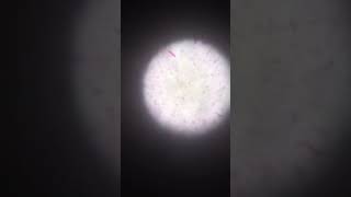 gram negative coccobacilli under microscopic ll blood culture ll microbiology [upl. by Doscher938]