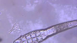 Demodex canis [upl. by Kean]