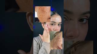 Demelan cream✨youtubeshorts shortvideo skincareroutine foryou viral trending glow ingskin✨ [upl. by Lemraj]