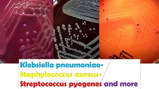 KlebsiellaStaphylococcus Betahaemolytic Streptococci Enterococcus Serratia Micrococcus [upl. by Cointon]