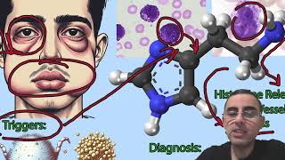 Understanding Hives Urticaria Symptoms Causes and Treatments [upl. by Aidnama]