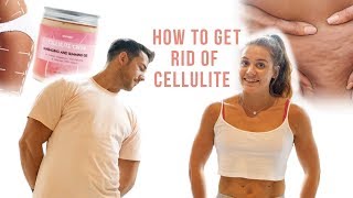 CELLULITE REMOVAL What They Dont Tell YOU [upl. by Lanor]