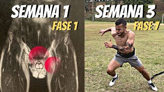 Como curei minha pubalgia EM 3 SEMANAS Como tratar e exercícios [upl. by Vanya]