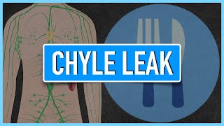 Chyle Leak  Emphasis on DietNutrition [upl. by Taima]