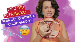 DIU BAIXO FUNCIONA O QUE FAZER  Mariana Viza [upl. by Leotie]