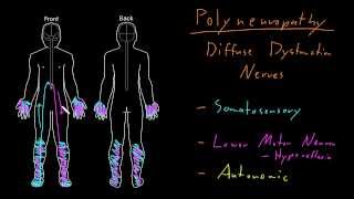 Syndrome Polyneuropathy [upl. by Liebowitz7]