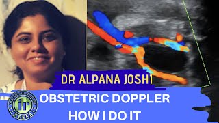 Obstetric Doppler  How I Do It  Dr Alpana Joshi  UMBILICAL ARTERY DOPPLER  MCA PI [upl. by Spooner]