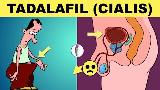 Tadalafil  Cialis  Erectile Dysfunction Treatment  Cialis for ED  ED Treatment [upl. by Ayk]