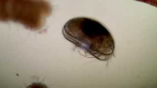 貝形虫の1種 Ostracoda sp [upl. by Anerroc]